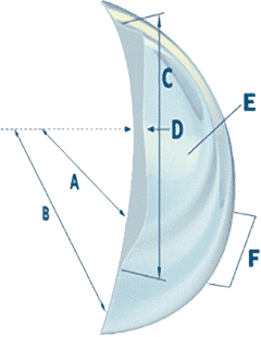 Keratoconus Contact Len Novakone